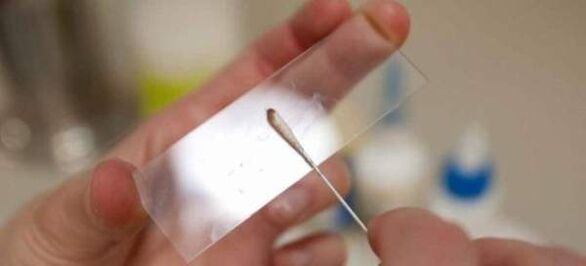 Skrobanie jaj robaków